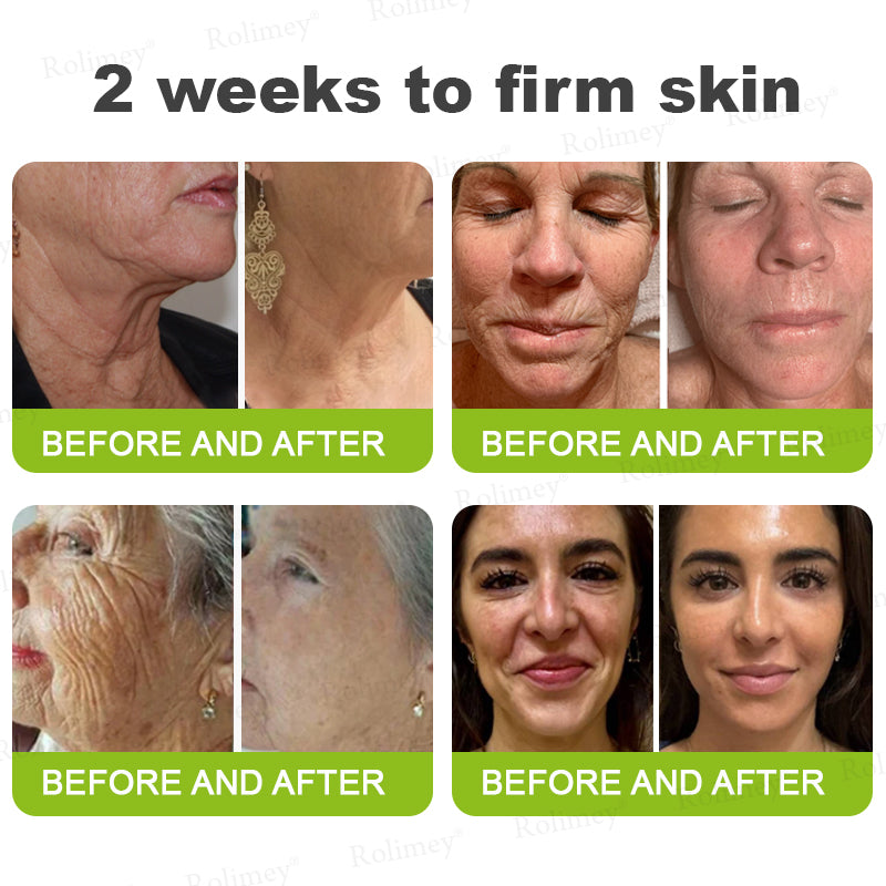 UPSELL👨‍⚕️💫Rolimey® Wrinkle-Lift Tightening cream