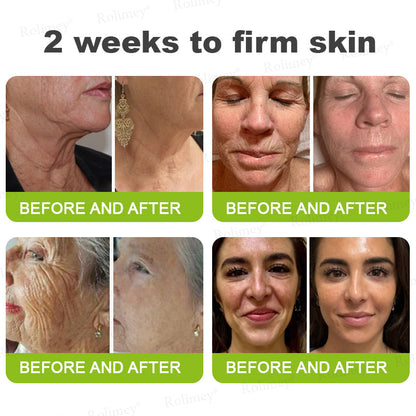 UPSELL👨‍⚕️💫Rolimey® Wrinkle-Lift Tightening cream