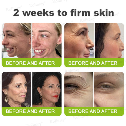 UPSELL👨‍⚕️💫Rolimey® Wrinkle-Lift Tightening cream