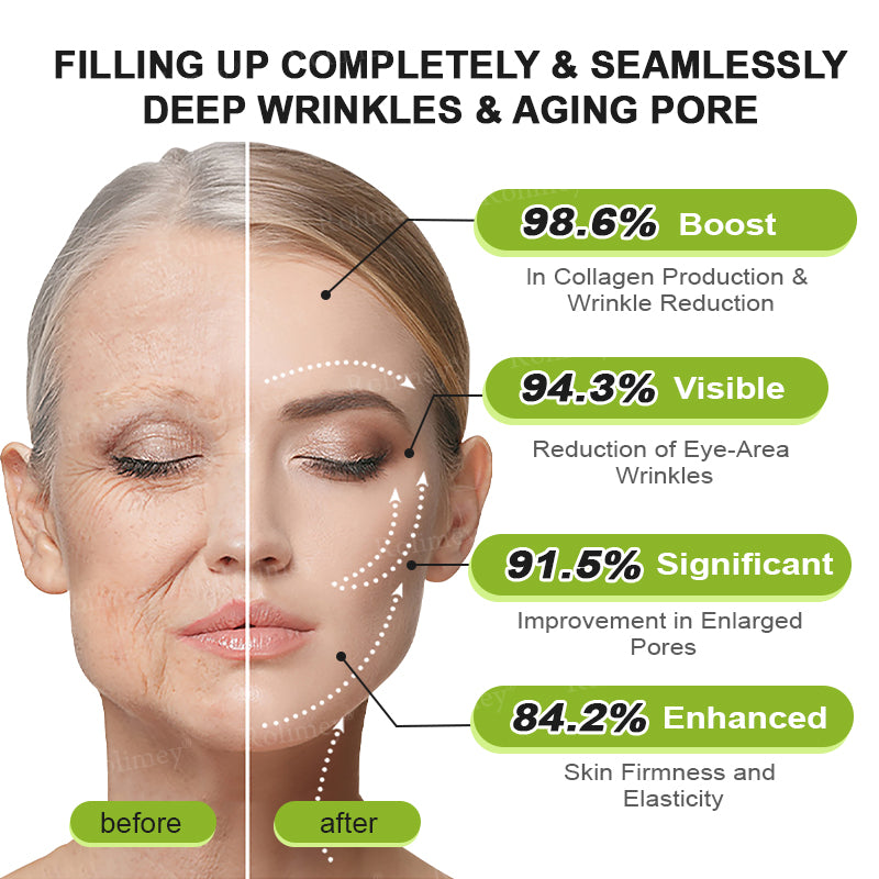 UPSELL👨‍⚕️💫Rolimey® Wrinkle-Lift Tightening cream