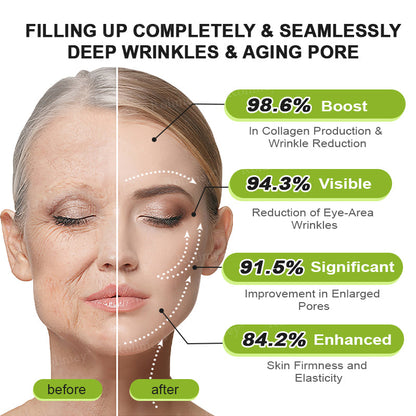 UPSELL👨‍⚕️💫Rolimey® Wrinkle-Lift Tightening cream