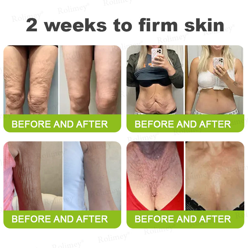 UPSELL👨‍⚕️💫Rolimey® Wrinkle-Lift Tightening cream