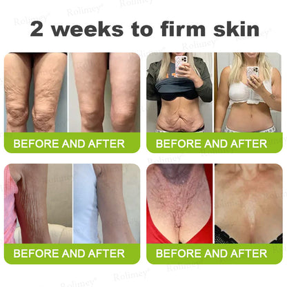 UPSELL👨‍⚕️💫Rolimey® Wrinkle-Lift Tightening cream