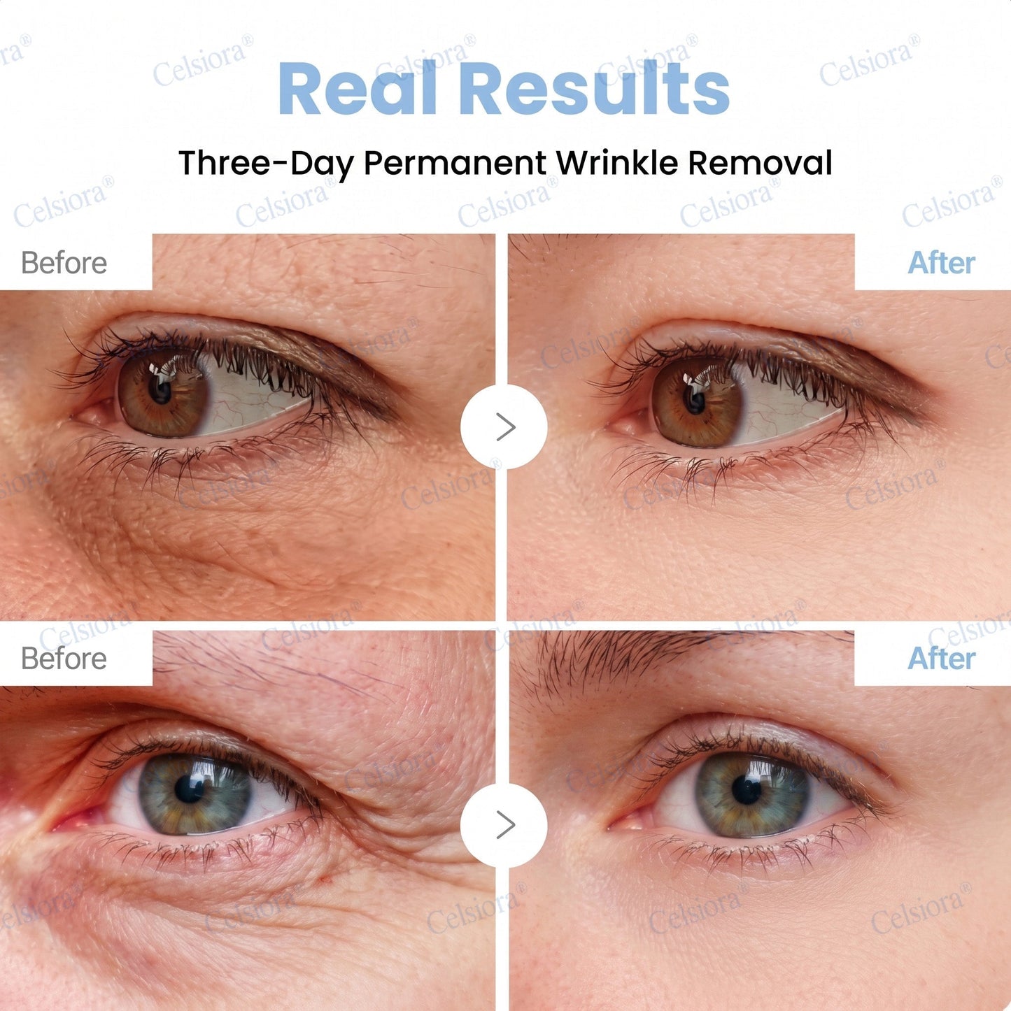 🟢🥈Celsiora® PDRN Anti-Wrinkle Shot – Lift & Firming Cream
