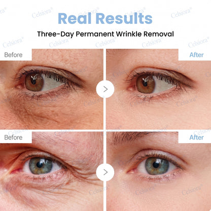 🟢🥈Celsiora® PDRN Anti-Wrinkle Shot – Lift & Firming Cream